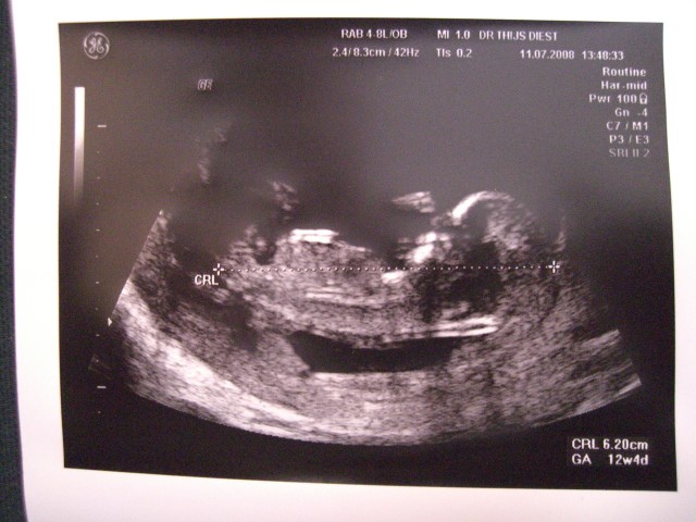 Hier is ons mupke 12 weken en 4 dagen :p (l)